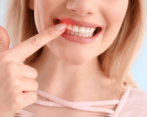 Periodontics