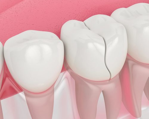 Treatment-of-Facial-Injury